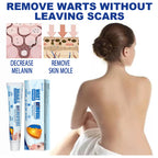 PureSkin Fresh Cream