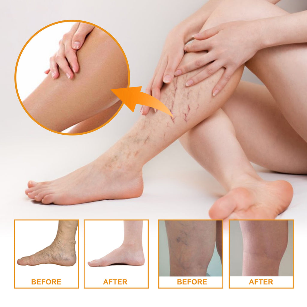 VitaK Leg Care Cream