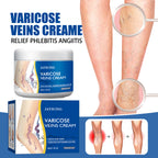 Leg Vein Relief Cream