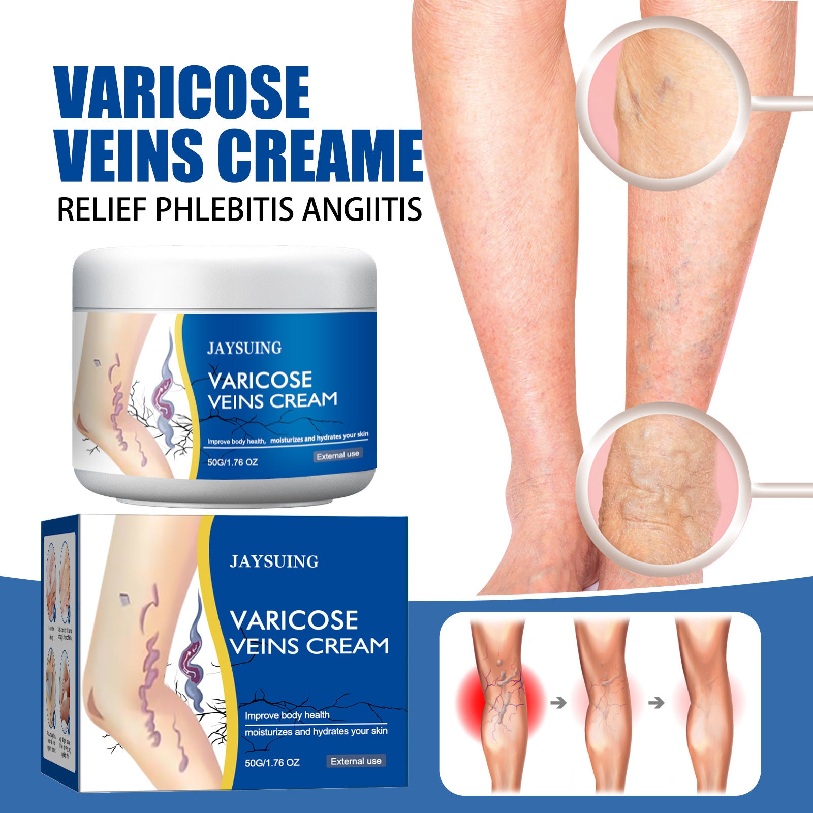 Leg Vein Relief Cream