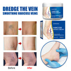 Leg Vein Relief Cream