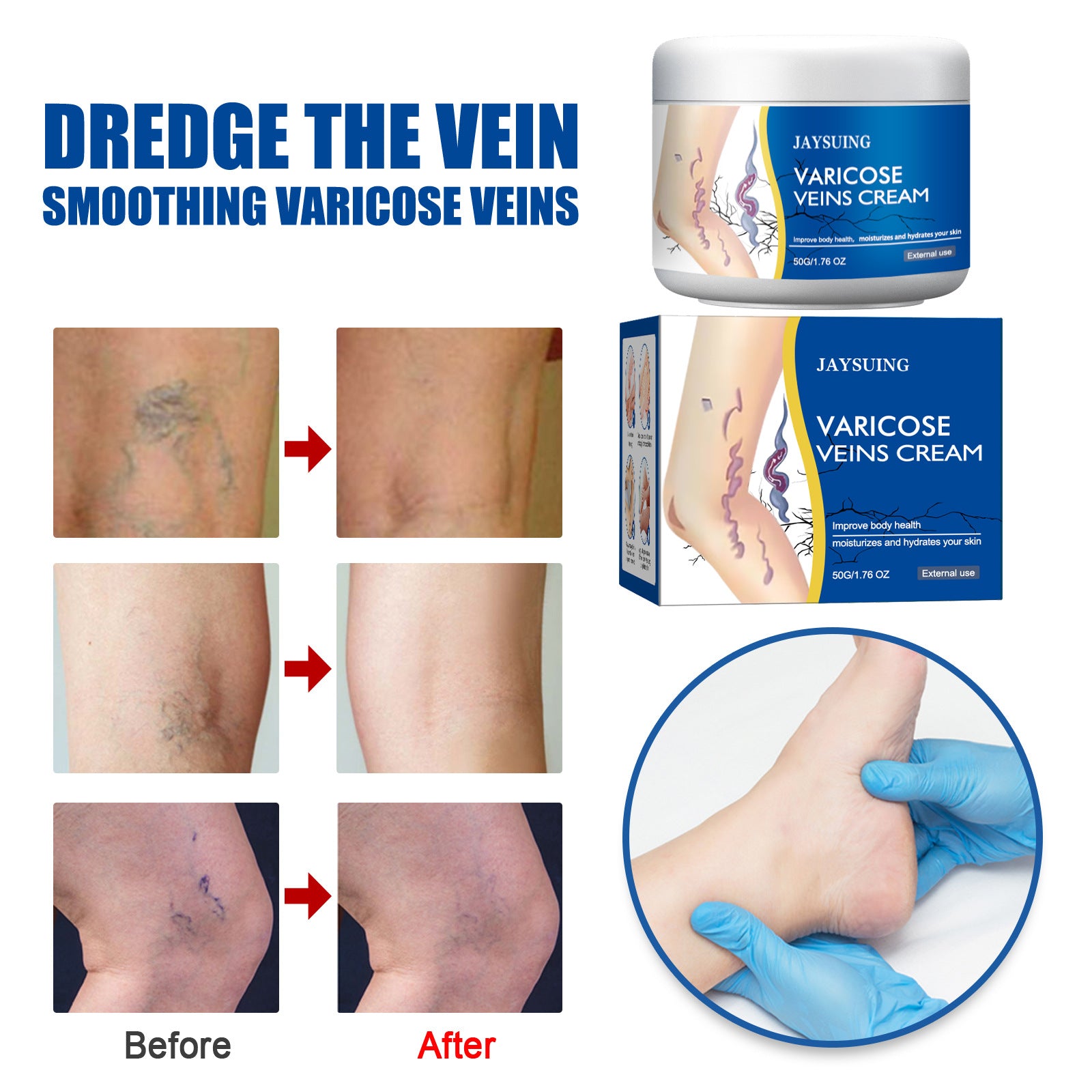 Leg Vein Relief Cream