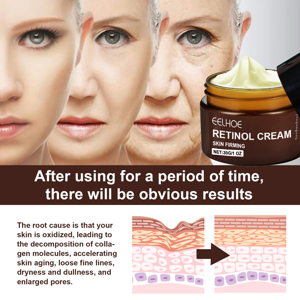 YouthRenew Retinol Cream