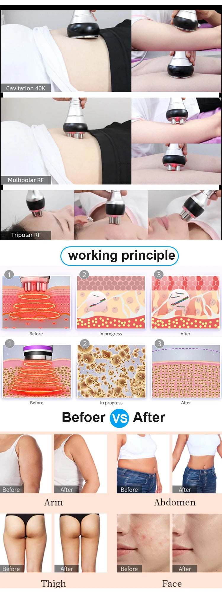 3-in-1 Slimming Massager