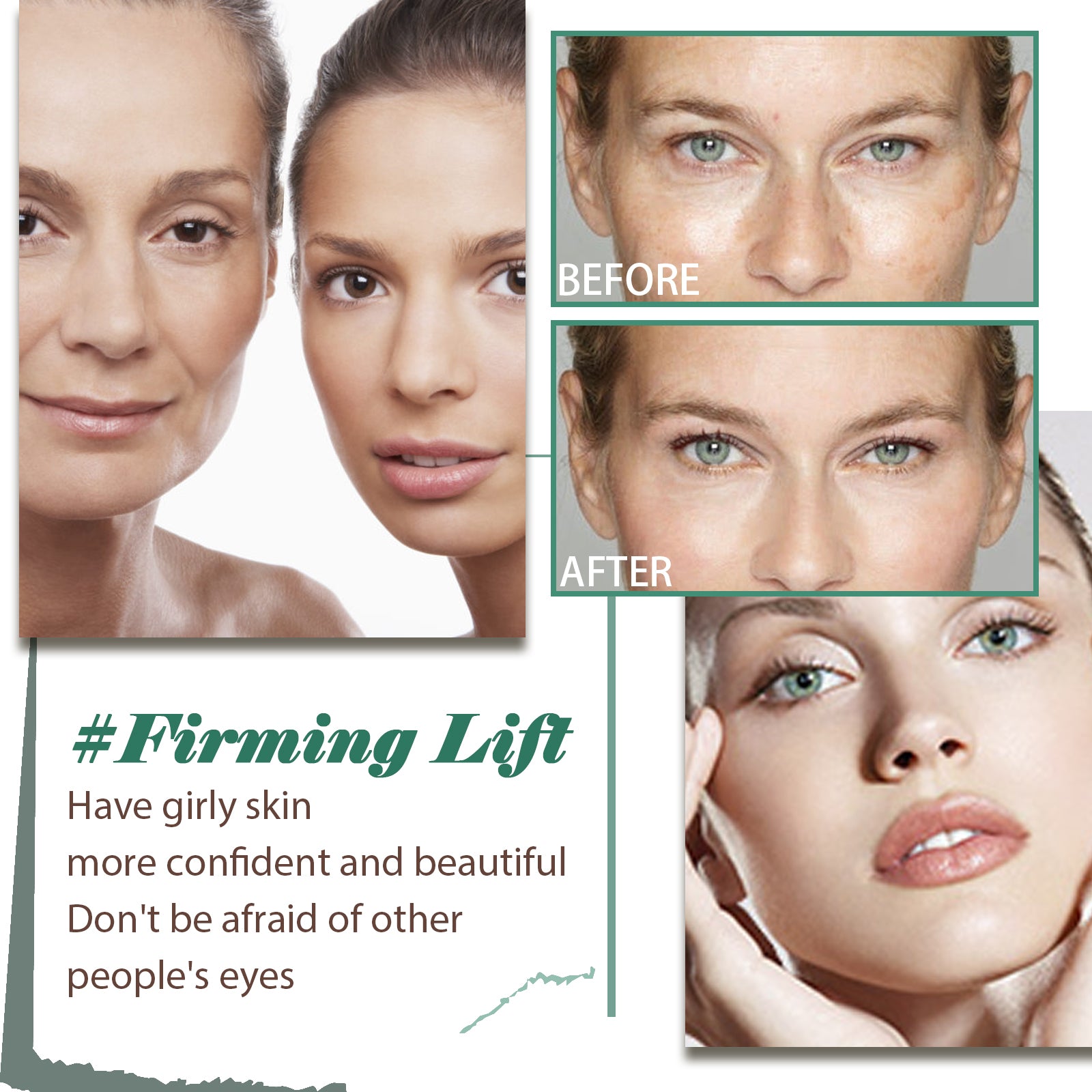 YouthLift Anti-Wrinkle Cream
