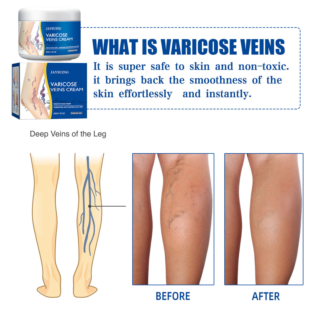 Leg Vein Relief Cream