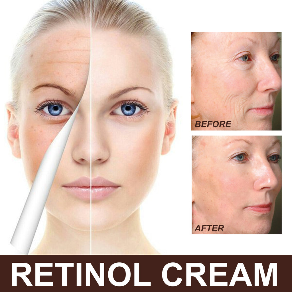 YouthRenew Retinol Cream