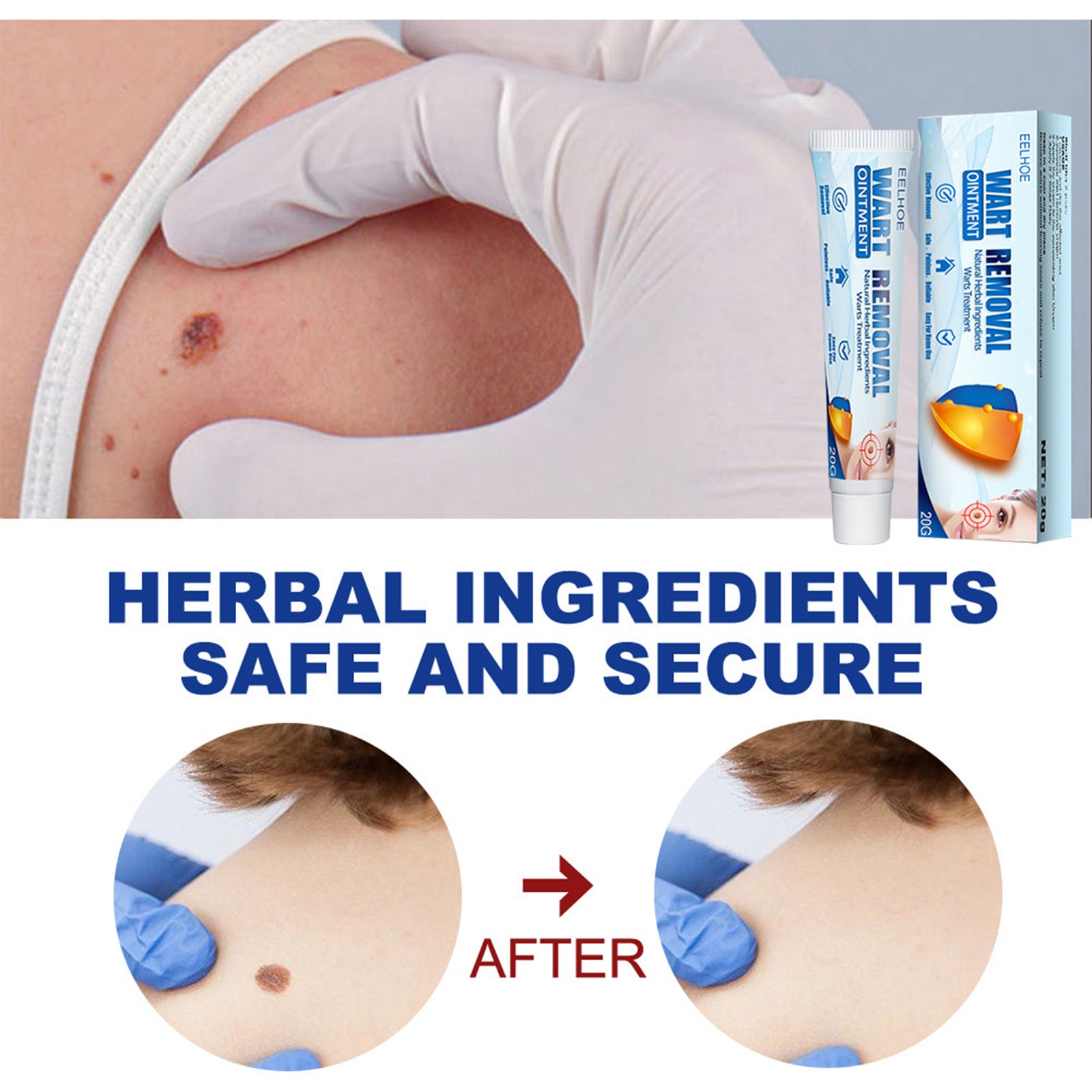 PureSkin Fresh Cream